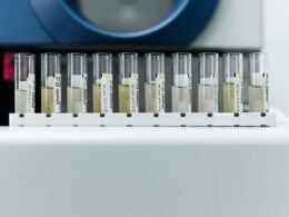 Laboratuvarda test örneği