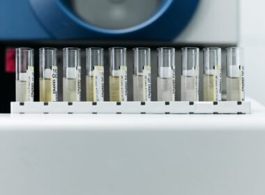 Laboratuvarda test örneği
