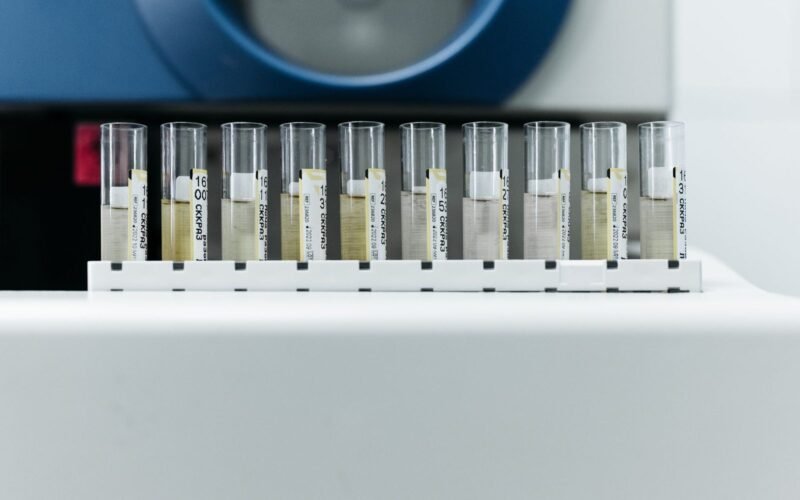 Laboratuvarda test örneği