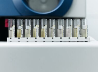 Cinsel Yolla Bulaşan Enfeksiyonlar: Korunma ve Tarama
